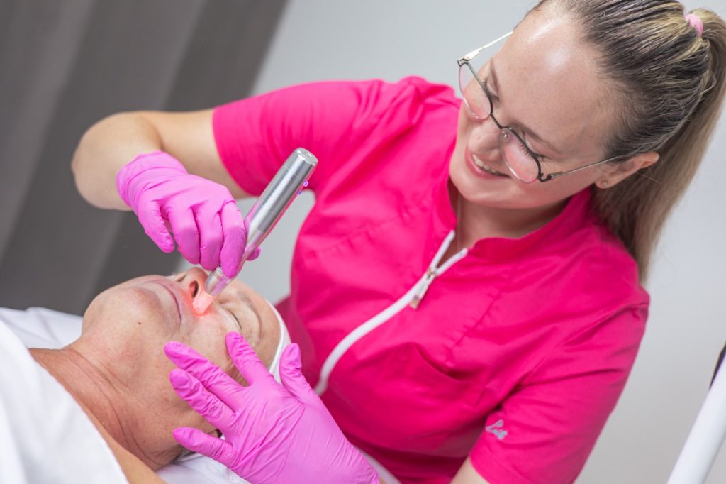 microneedling